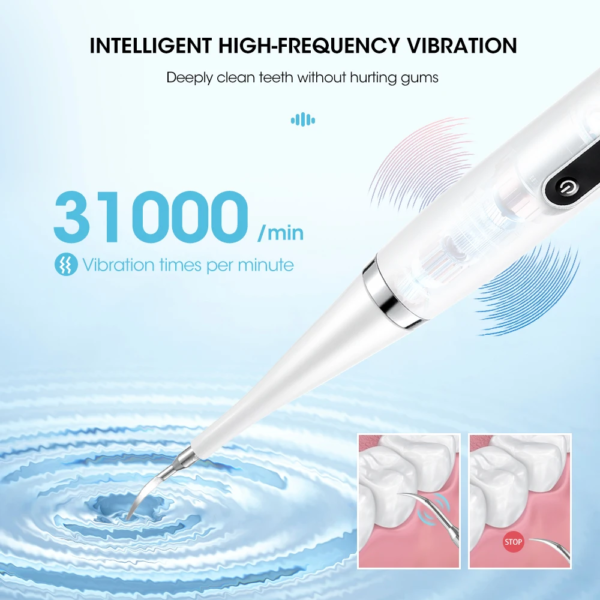 Electric Tooth Whitening Brush - Image 4